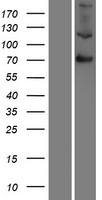 Factor XIII (F13B) Human Over-expression Lysate