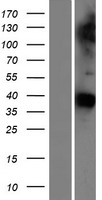 GAS1 Human Over-expression Lysate