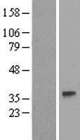 GJA4 Human Over-expression Lysate