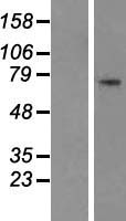 Histidine decarboxylase (HDC) Human Over-expression Lysate