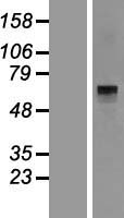 Histidase (HAL) Human Over-expression Lysate