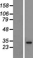 HLA-DRB5 Human Over-expression Lysate