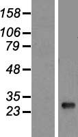 HLA-DQB1 Human Over-expression Lysate