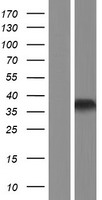 HOXB1 Human Over-expression Lysate