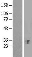 Histatin 1 (HTN1) Human Over-expression Lysate