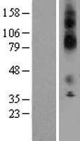 Kir7.1 (KCNJ13) Human Over-expression Lysate