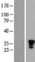 CD161 (KLRB1) Human Over-expression Lysate