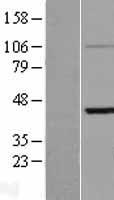 KRTHA3B (KRT33B) Human Over-expression Lysate