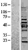 Cytokeratin 19 (KRT19) Human Over-expression Lysate