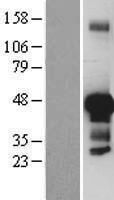 JUNB Human Over-expression Lysate