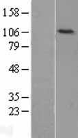 DNA Ligase IV (LIG4) Human Over-expression Lysate