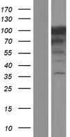 MCC Human Over-expression Lysate