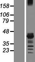 MSI1 Human Over-expression Lysate