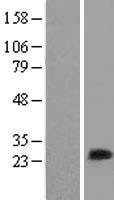 MLC1SA (MYL6B) Human Over-expression Lysate