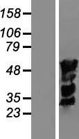 MUM1 (IRF4) Human Over-expression Lysate