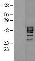 P2X3 (P2RX3) Human Over-expression Lysate
