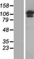 OGDH Human Over-expression Lysate