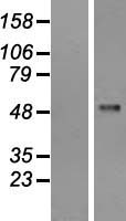 PFKFB1 Human Over-expression Lysate