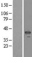 MASPIN (SERPINB5) Human Over-expression Lysate