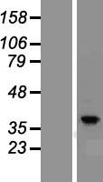 PRKACG Human Over-expression Lysate