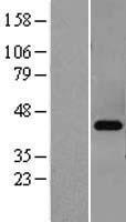 PRKACB Human Over-expression Lysate