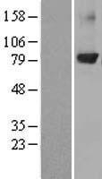 PKC beta 1 (PRKCB) Human Over-expression Lysate