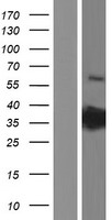 PRPS2 Human Over-expression Lysate