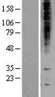 Proteasome beta 1 (PSMB1) Human Over-expression Lysate
