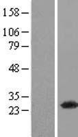 PSMD10 Human Over-expression Lysate