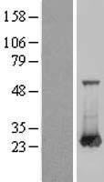 RAB6A Human Over-expression Lysate