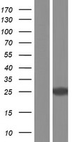 RAB3B Human Over-expression Lysate