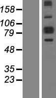P5CS (ALDH18A1) Human Over-expression Lysate