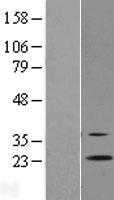 RGR Human Over-expression Lysate