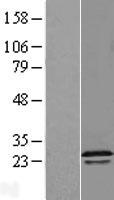 RGS16 Human Over-expression Lysate