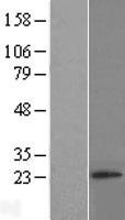 RNF4 Human Over-expression Lysate