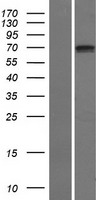 SCNN1D Human Over-expression Lysate