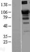 SATB1 Human Over-expression Lysate
