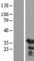 SGTA Human Over-expression Lysate