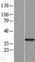 SFRP1 Human Over-expression Lysate