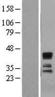 SIAT4A (ST3GAL1) Human Over-expression Lysate