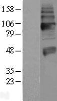 Vesicular Acetylcholine Transporter (SLC18A3) Human Over-expression Lysate
