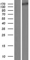 SLIT1 Human Over-expression Lysate