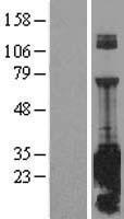 SNAP25 Human Over-expression Lysate