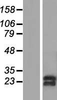SNRPC Human Over-expression Lysate