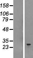SNRPB Human Over-expression Lysate