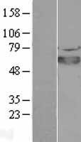 SOX4 Human Over-expression Lysate