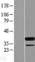 SPIB Human Over-expression Lysate