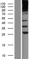 SPTBN1 Human Over-expression Lysate