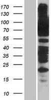 SSRP1 Human Over-expression Lysate