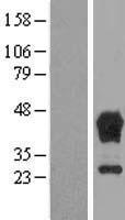 TBCC Human Over-expression Lysate